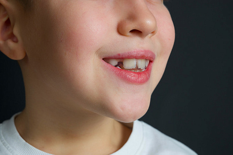 Капы Sky Kids 7-9 лет